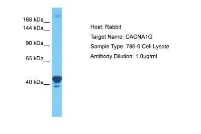 Western Blot: CACNA1G Antibody [NBP1-80105]