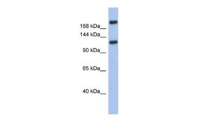 Western Blot: CACNA1I Antibody [NBP2-88775]