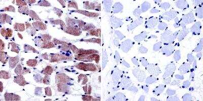 Immunohistochemistry-Paraffin: CACNA1S Antibody (1A) - BSA Free [NB300-542]