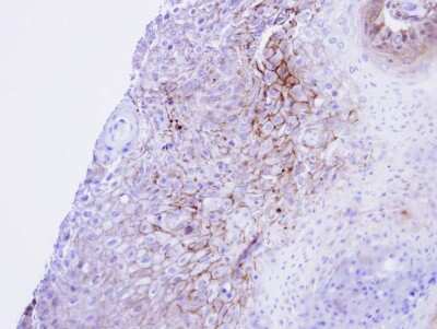 Immunohistochemistry-Paraffin: CACNA1S Antibody [NBP1-31659]