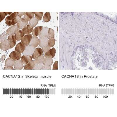 Immunohistochemistry-Paraffin: CACNA1S Antibody [NBP2-33541]