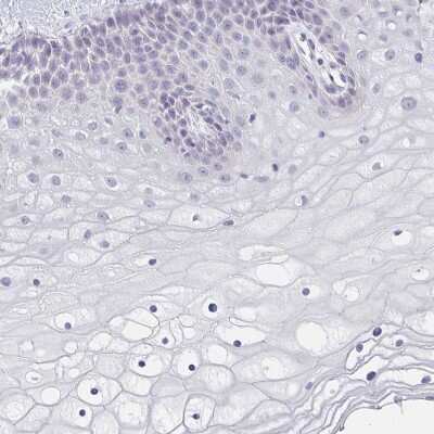 Immunohistochemistry-Paraffin: CACNA1S Antibody [NBP2-33541]