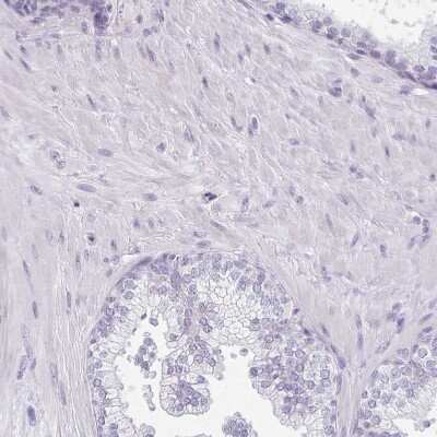 Immunohistochemistry-Paraffin: CACNA1S Antibody [NBP2-33541]