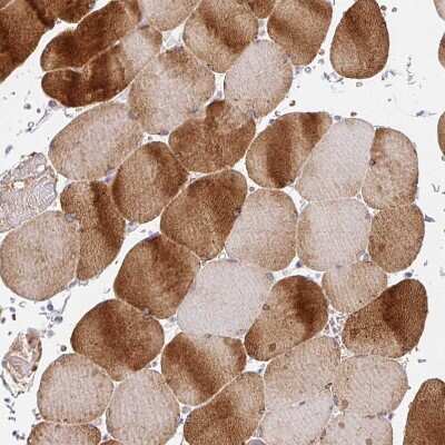 Immunohistochemistry-Paraffin: CACNA1S Antibody [NBP2-33541]