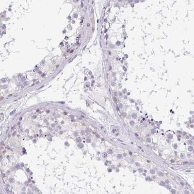 Immunohistochemistry-Paraffin: CACNA1S Antibody [NBP2-33541]