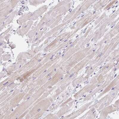 Immunohistochemistry-Paraffin: CACNA1S Antibody [NBP2-33799]