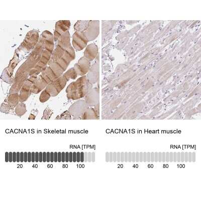 Immunohistochemistry-Paraffin: CACNA1S Antibody [NBP2-33799]