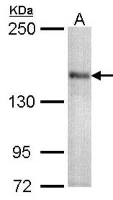 Western Blot: CACNA1S Antibody [NBP1-31659]