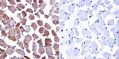 Immunohistochemistry-Paraffin: CACNA2D1 Antibody (20A) [NB120-2864]