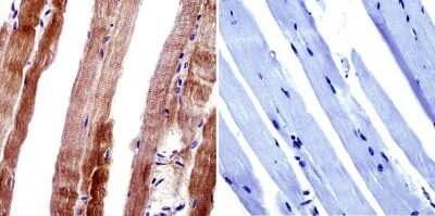 Immunohistochemistry-Paraffin: CACNA2D1 Antibody (20A) [NB120-2864]