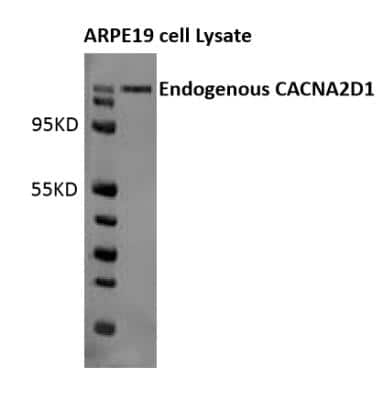 Western Blot: CACNA2D1 Antibody (20A) [NB120-2864]