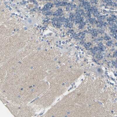 Immunohistochemistry-Paraffin: CACNA2D1 Antibody [NBP1-86682]