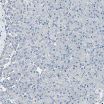 Immunohistochemistry-Paraffin: CACNA2D1 Antibody [NBP1-86682]