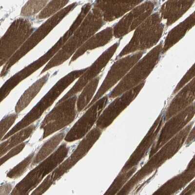 Immunohistochemistry-Paraffin: CACNA2D1 Antibody [NBP1-86682]