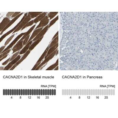 Immunohistochemistry-Paraffin: CACNA2D1 Antibody [NBP1-86682]