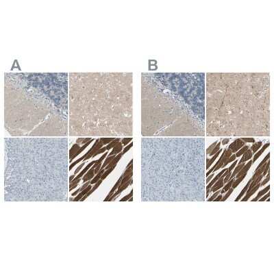 Immunohistochemistry-Paraffin: CACNA2D1 Antibody [NBP1-86682]