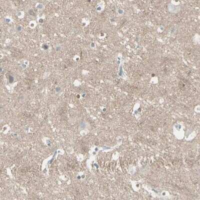 Immunohistochemistry-Paraffin: CACNA2D1 Antibody [NBP1-86682]