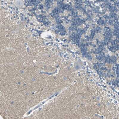 Immunohistochemistry-Paraffin: CACNA2D1 Antibody [NBP1-86683]
