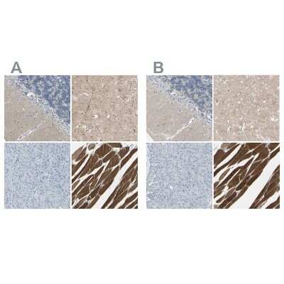 Immunohistochemistry-Paraffin: CACNA2D1 Antibody [NBP1-86683]