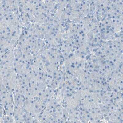 Immunohistochemistry-Paraffin: CACNA2D1 Antibody [NBP1-86683]