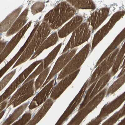 Immunohistochemistry-Paraffin: CACNA2D1 Antibody [NBP1-86683]