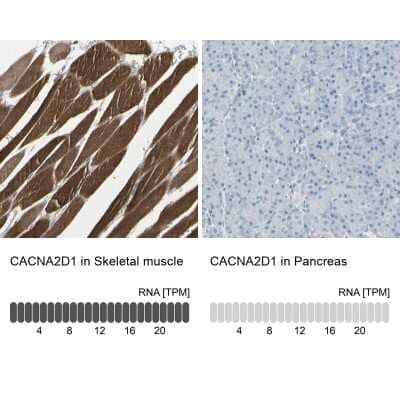 Immunohistochemistry-Paraffin: CACNA2D1 Antibody [NBP1-86683]