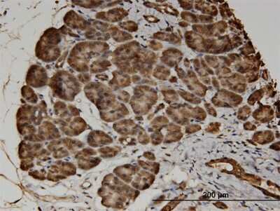 Immunohistochemistry-Paraffin: CACNA2D2 Antibody (3A4) [H00009254-M05]