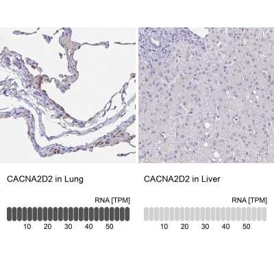 Immunohistochemistry-Paraffin: CACNA2D2 Antibody [NBP1-81501]