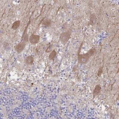 Immunohistochemistry-Paraffin: CACNA2D2 Antibody [NBP1-81501]