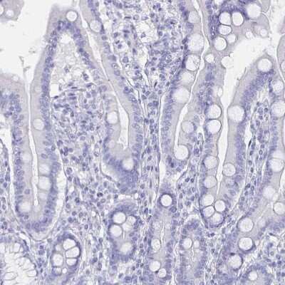 Immunohistochemistry-Paraffin: CACNA2D2 Antibody [NBP1-81501]