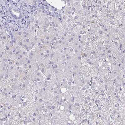 Immunohistochemistry-Paraffin: CACNA2D2 Antibody [NBP1-81501]