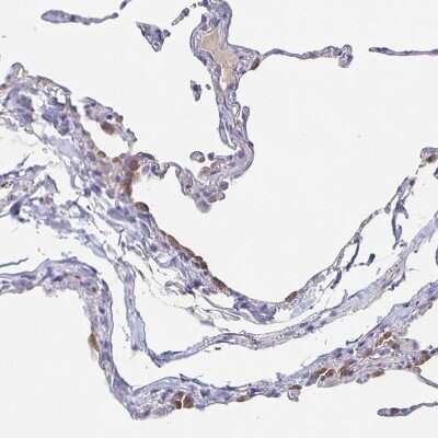 Immunohistochemistry-Paraffin: CACNA2D2 Antibody [NBP1-81501]