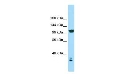 Western Blot: CACNA2D2 Antibody [NBP3-10676]