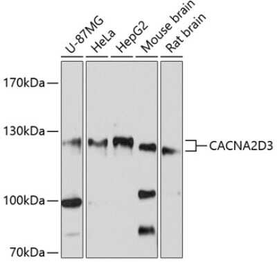 Western Blot: CACNA2D3 AntibodyBSA Free [NBP2-92012]