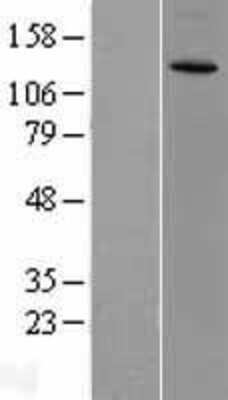 Western Blot: CACNA2D3 Overexpression Lysate [NBL1-08627]