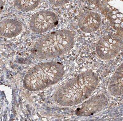 Immunohistochemistry-Paraffin: CACNA2D4 Antibody [NBP1-85920]