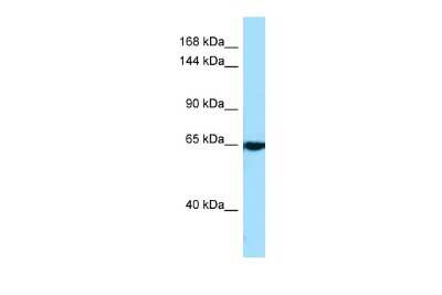 Western Blot: CACNA2D4 Antibody [NBP2-87111]