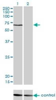 Western Blot: CACNB1 Antibody (1G6) [H00000782-M01]