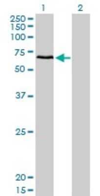 Western Blot: CACNB1 Antibody (1G6) [H00000782-M01]