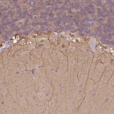 Immunohistochemistry-Paraffin: CACNB1 Antibody [NBP1-86681]