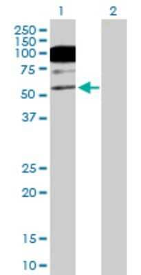 Western Blot: CACNB1 Antibody [H00000782-B01P]