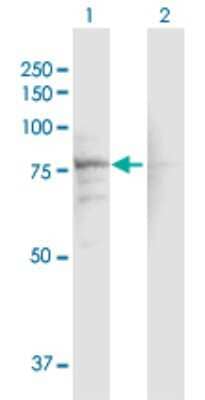 Western Blot: CACNB1 Antibody [H00000782-D01P]