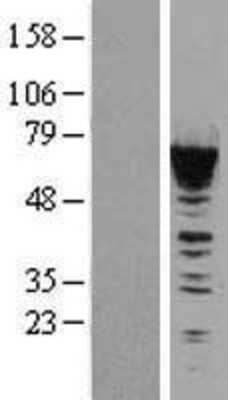 Western Blot: CACNB1 Overexpression Lysate [NBL1-08628]