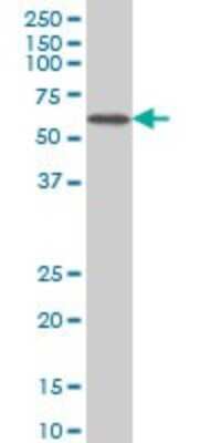 Western Blot: CACNB2 Antibody (6C1) [H00000783-M01]