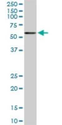 Western Blot: CACNB2 Antibody (6C1) [H00000783-M01]