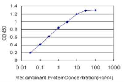ELISA: CACNB2 Antibody (6C4) [H00000783-M05]