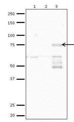 Western Blot: CACNB2 Antibody (6C4) [H00000783-M05]