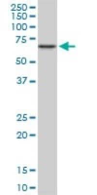 Western Blot: CACNB2 Antibody (6C4) [H00000783-M05]