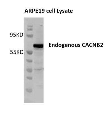 Western Blot: CACNB2 Antibody (6C4) [H00000783-M05]