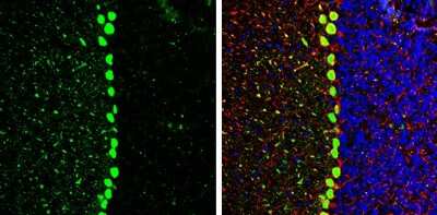 Immunohistochemistry-Frozen: CACNB2 Antibody [NBP3-13049]